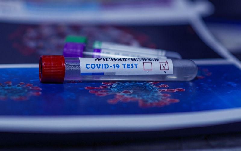 Covid-19 test
